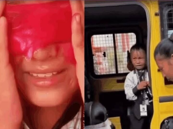 मोबाइल की लत छुड़ाने के लिए बच्चों को डराने का वीडियो वायरल, डॉक्टर ने निकाल दीं दोनों आंखें